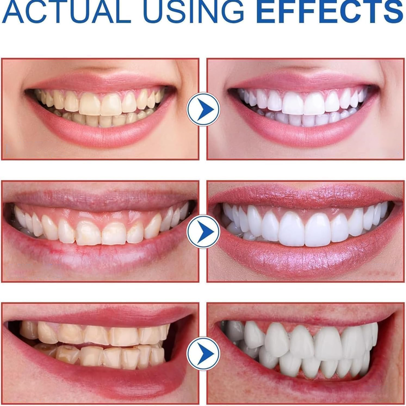 ✨AEXZR® SP-8 Probiotic Whitening Toothpaste🦷