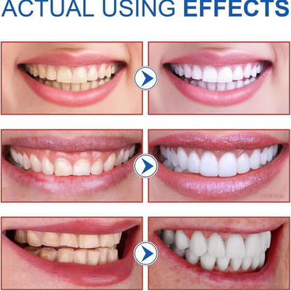 ✨AEXZR® SP-8 Probiotic Whitening Toothpaste🦷