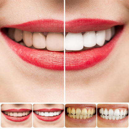 ✨AEXZR® SP-8 Probiotic Whitening Toothpaste🦷